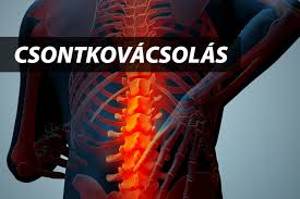 Csontkovácsolás